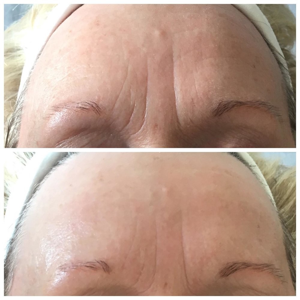 Aromavita Bella Donna #varazdin Tretman lica Thavma therapy