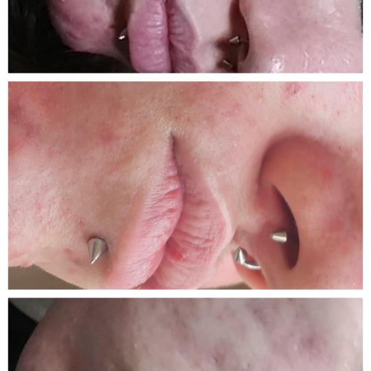 Cosmoderm & Centar Estetica usluga