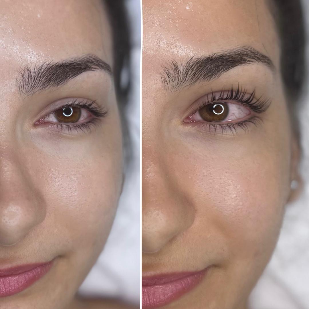 Anova Aesthetics #zagreb Trepavice Lash lift + bojanje trepavica