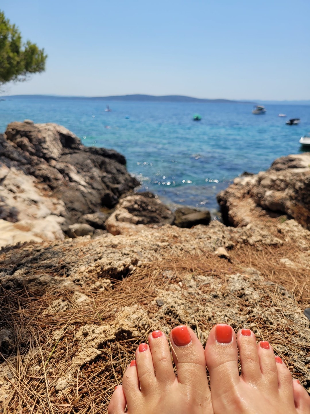 Cosmoderm & Centar Estetica #zagreb Medicinska pedikura Medicinska pedikura + trajni lak