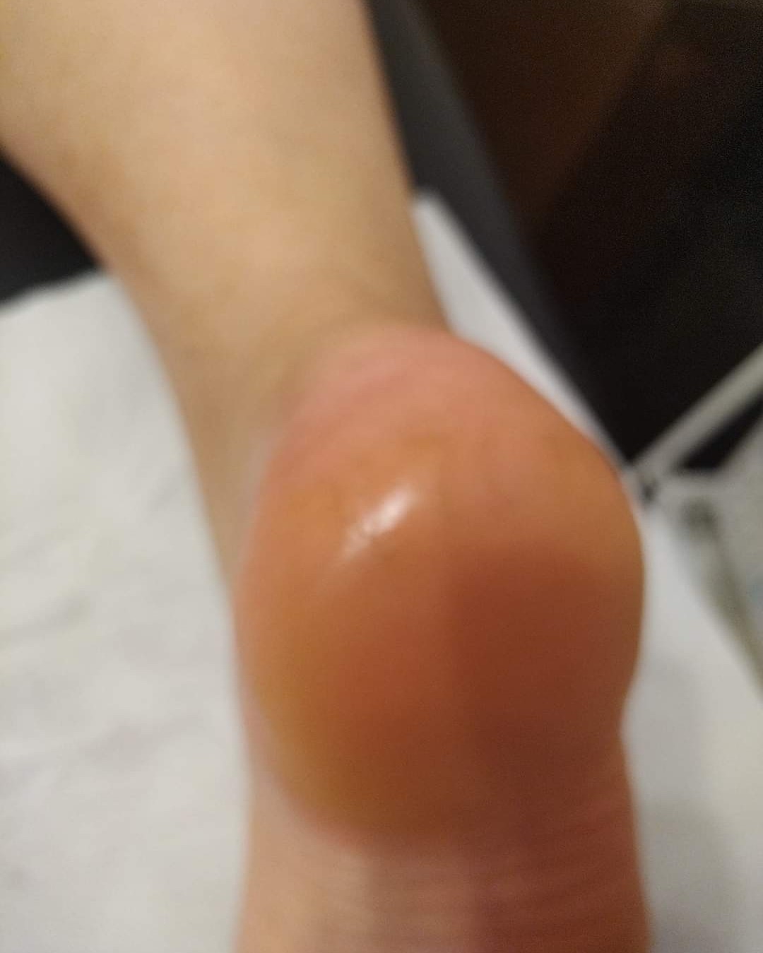 Pedikura ruska-manikura noktiju, obrada stopala profi diskom i masaža stopala - Beauty by Lina, Bjelovar Estetska pedikura Nokti Estetska pedikura, Bjelovar, Centar