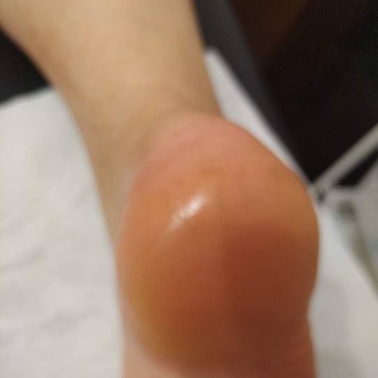 Beauty by Lina #bjelovar Estetska pedikura Pedikura ruska-manikura noktiju, obrada stopala profi dis