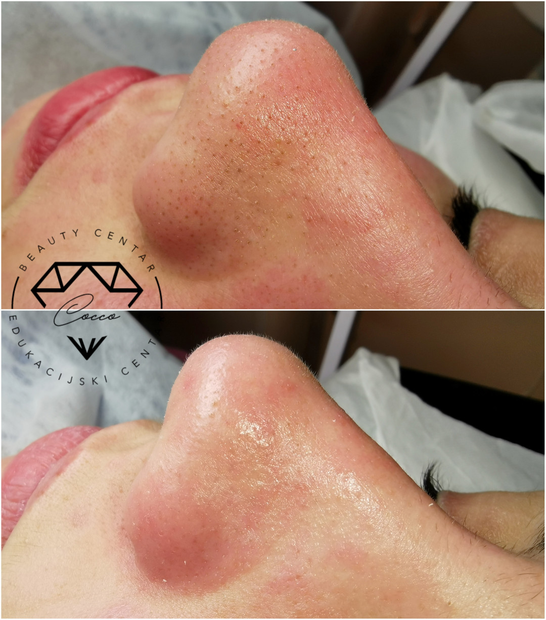 Beauty Centar By Cocco #viskovo Tretman lica