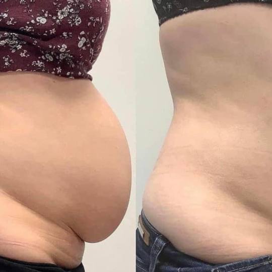 Estetix centar usluga