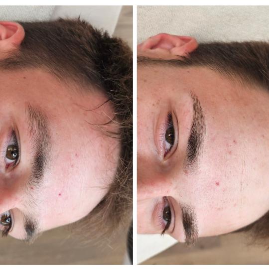 Cosmoderm & Centar Estetica #zagreb Obrve Oblikovanje obrva Oblikovanje obrva je tretman kojim čupk