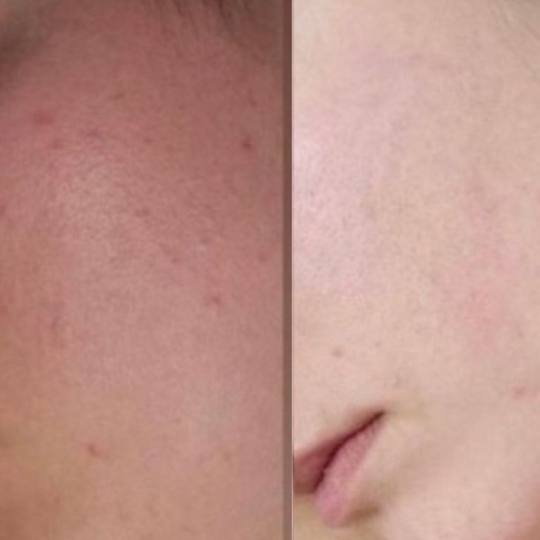 Madero&Beauty Gabrijela usluga