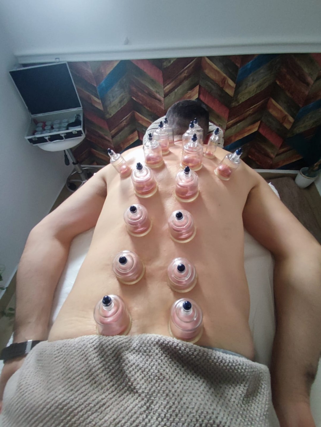 S M Beauty Bloom #zadar Opća masaža Cupping masaža