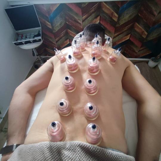 S M Beauty Bloom #zadar Opća masaža Cupping masaža