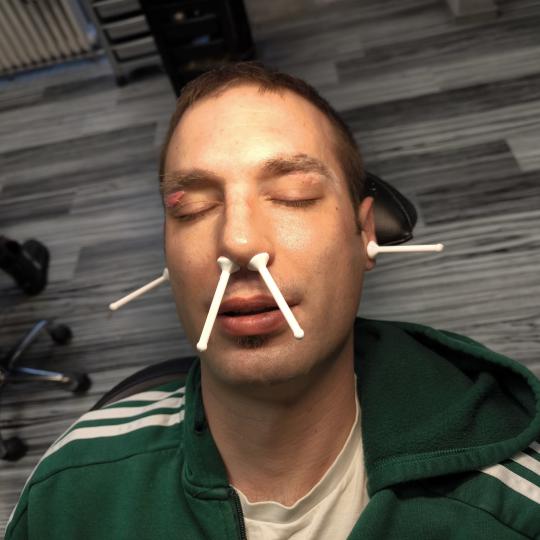 Mare #zagreb Obrve Depilacija lica voskom za gospodu - dlačice u nosu + dlačice u ušima + obrve I