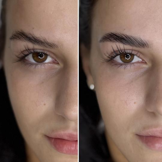Anova Aesthetics #zagreb Obrve Brow lift + korejski lash lift (sa oblikovanjem obrva i bojanjem)
