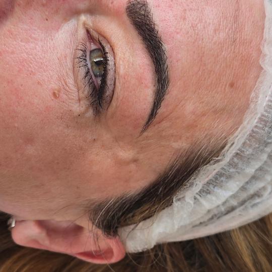 Cosmoderm & Centar Estetica usluga