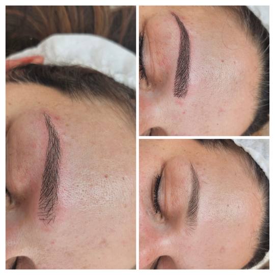 Cosmoderm & Centar Estetica #zagreb Trajna šminka Trajna šminka - iscrtavanje dlačica (hiper real