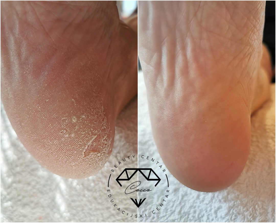 Beauty Centar By Cocco #viskovo Estetska pedikura