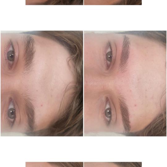 Cosmoderm & Centar Estetica #zagreb Obrve Oblikovanje obrva Oblikovanje obrva, kada imamo dovoljno p
