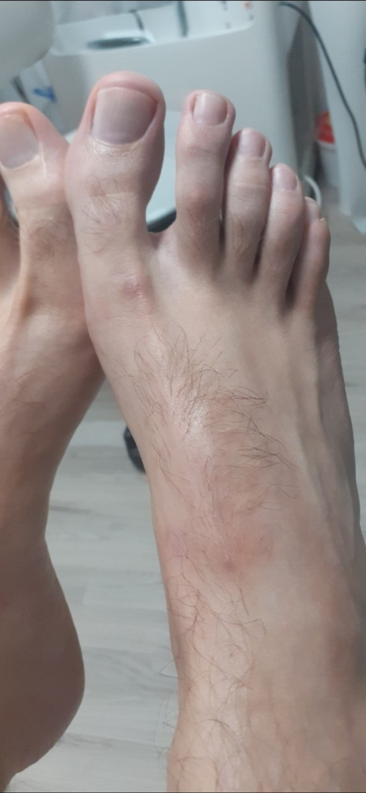 Cosmoderm & Centar Estetica #zagreb Medicinska pedikura Medicinska pedikura