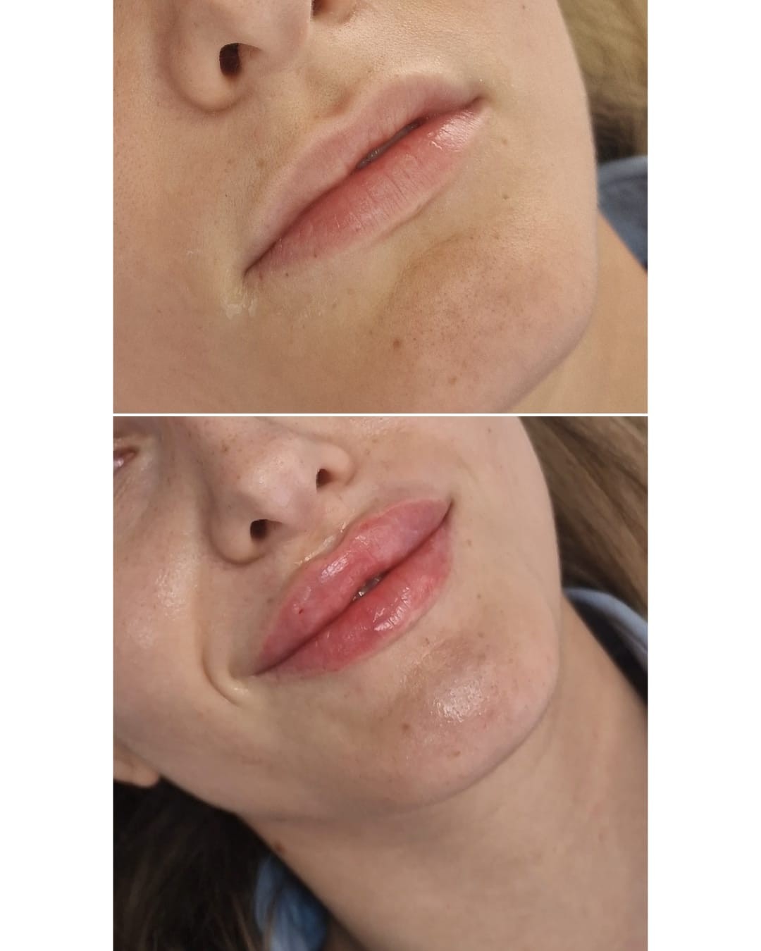 Adentis, Zagreb LookBook