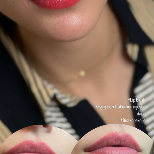 MOELL beauty #zagreb Trajna šminka Mikropigmentacija usana /Lip blush