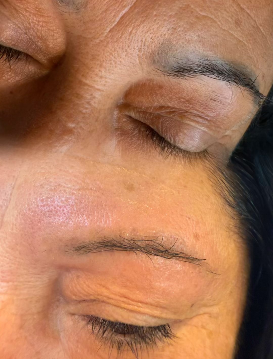 SABRINA STRIJA BEAUTY & SPA #zagreb Uklanjanje tetovaža Lasersko uklanjanje tetovaža - 10 x 10 cm