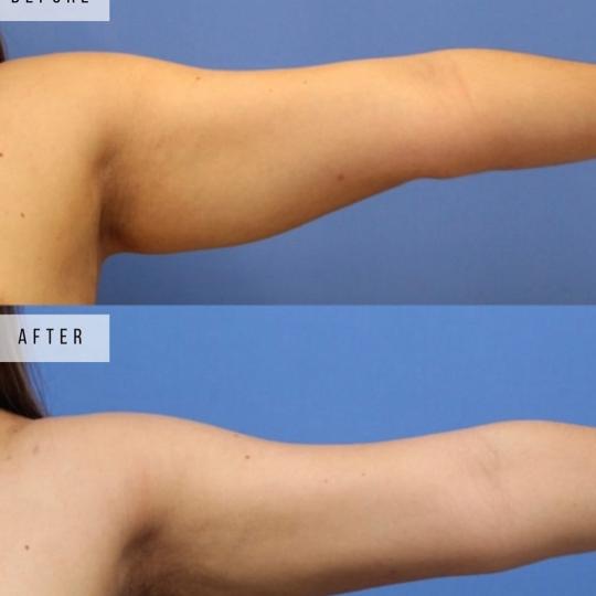 Perfect body beauty bar usluga