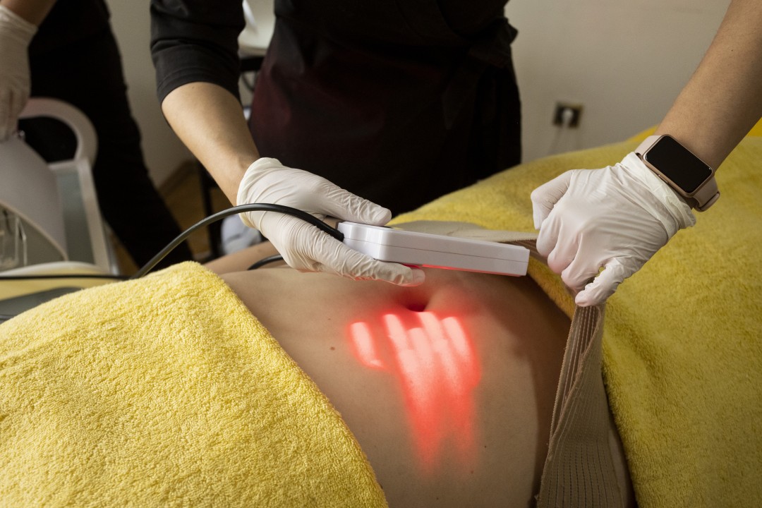 Wings of Beauty #zagreb Tretmani tijela Lipolaser