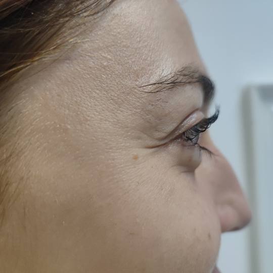 Beauty Clinique #zagreb Trepavice Lash lift Laminacija i bojanje trepavica uključeni u tretman