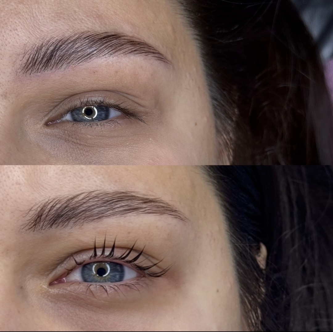 Lash lift + bojanje trepavica - Anova Aesthetics, Zagreb Trepavice Lice Trepavice, Zagreb, Trešnjevka – jug