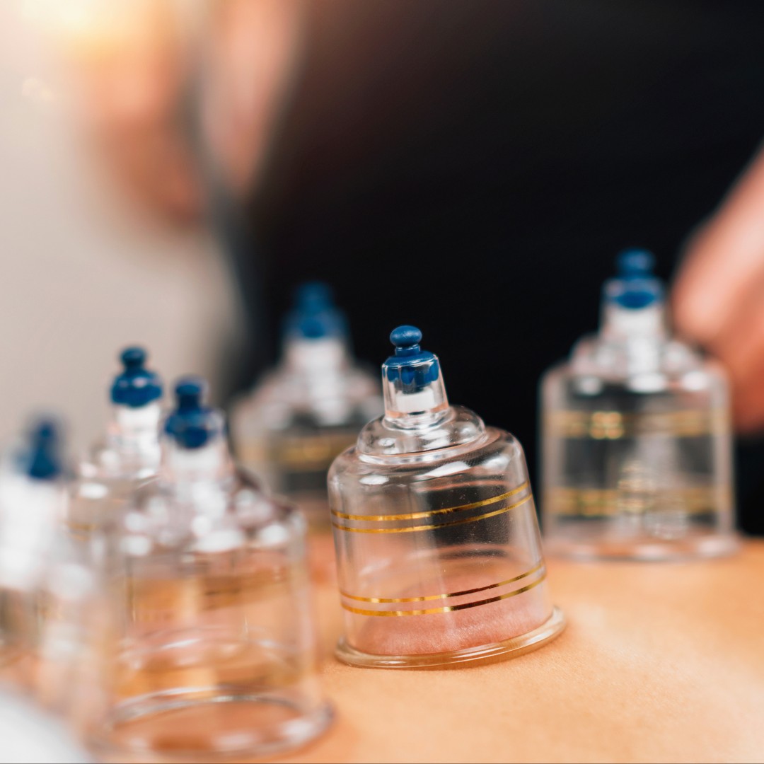 Aromavita Bella Donna #varazdin Opća masaža Cupping masaža - 25 minuta