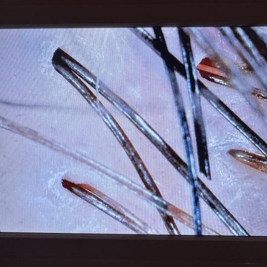 Yoko #jastrebarsko Masaža glave Japanski head spa + analiza vlasišta + sušenje kose za dame - 120