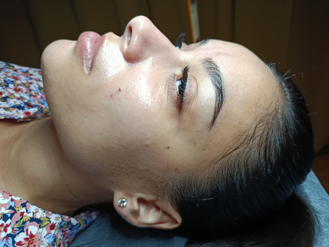 Beauty by Yvonne #zagreb Tretman lica Hydrafacial Platinum tretman lica