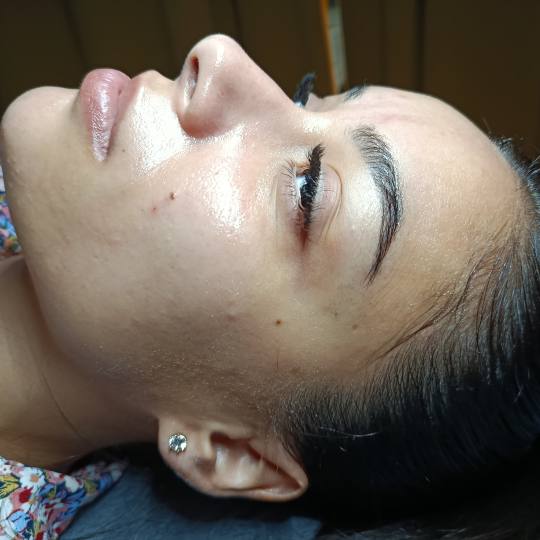 Beauty by Yvonne #zagreb Tretman lica Hydrafacial Platinum tretman lica
