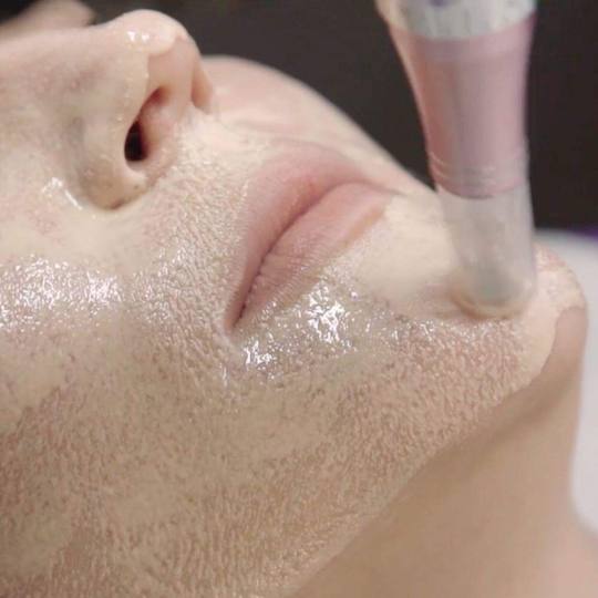 Antiage beauty room Lady Goga usluga