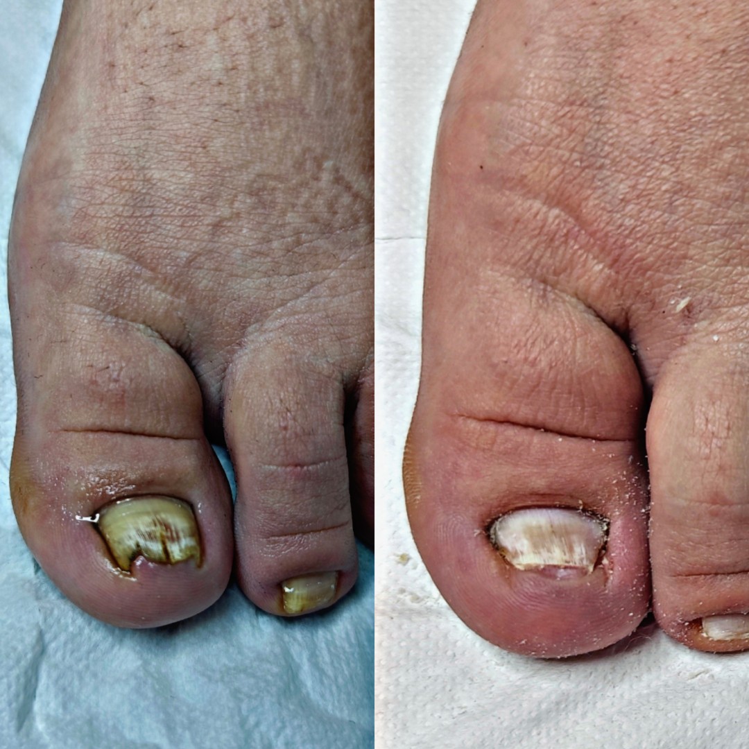 Medicinska pedikura - Roya Beauty & Hair Studio, Dugo Selo Medicinska pedikura Nokti Medicinska pedikura, Dugo Selo, Centar