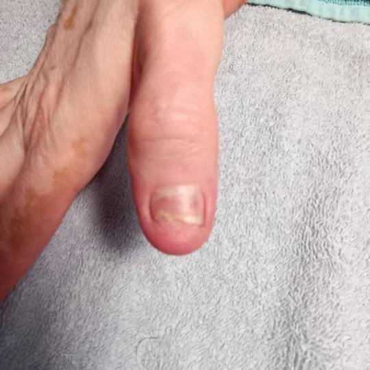 Boba Nail Bar #zagreb Korekcija noktiju Rekonstrukcija nokta / protetika - nokat