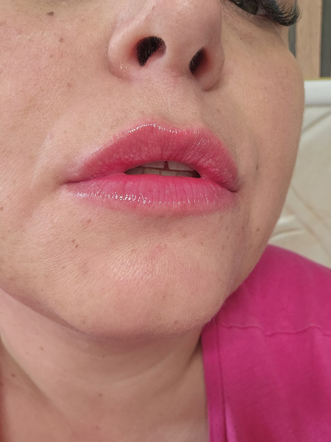 S M Beauty Bloom #zadar Trajna šminka Kissed lips - nanopigmentacija