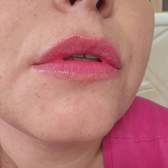 S M Beauty Bloom #zadar Trajna šminka Kissed lips - nanopigmentacija