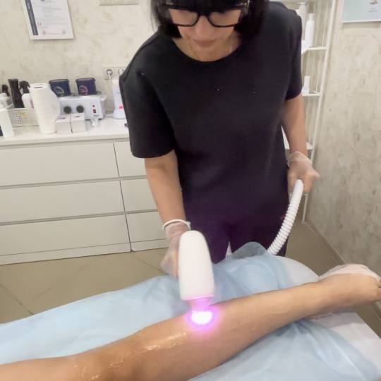 Angela #zagreb Laserska epilacija Laserska epilacija cijelih nogu - za dame