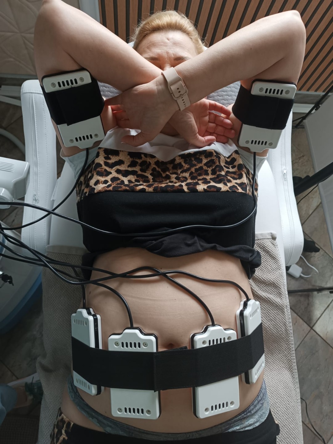 S M Beauty Bloom #zadar Tretmani tijela Lipo laser