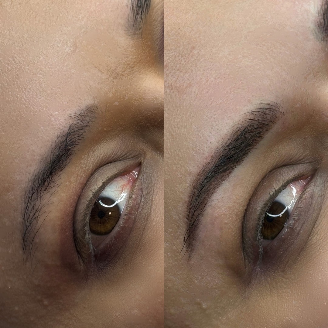 Anova Aesthetics #zagreb Trajna šminka Puder obrve