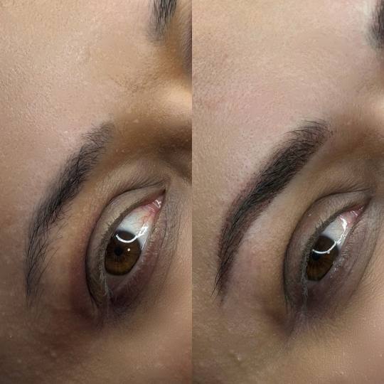 Anova Aesthetics usluga