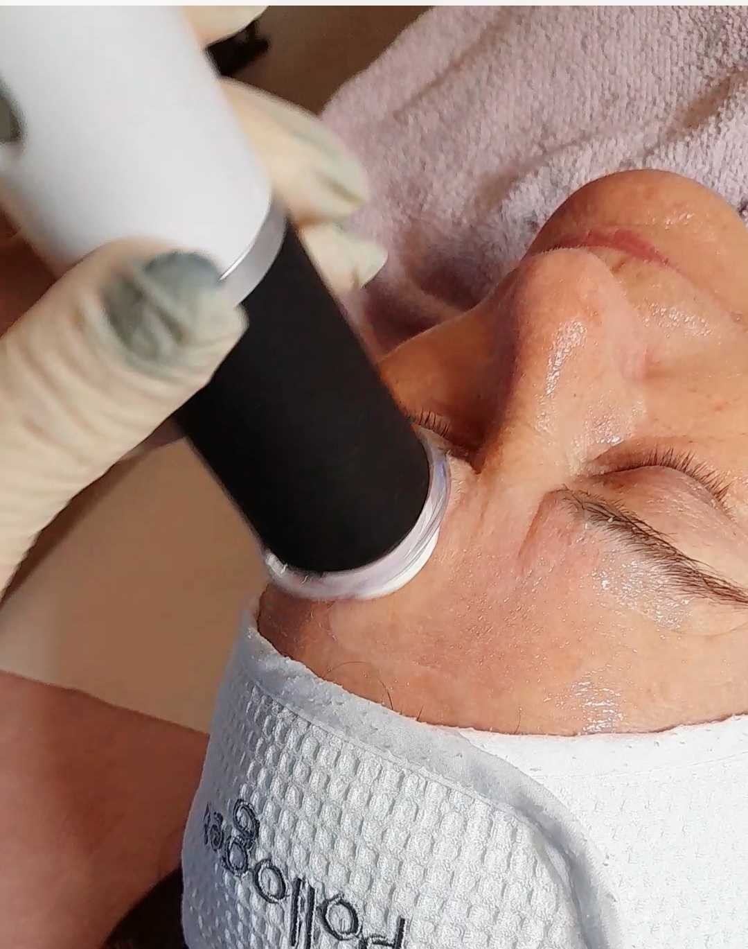 Natural #rijeka Lifting / zatezanje kože Oxygeneo