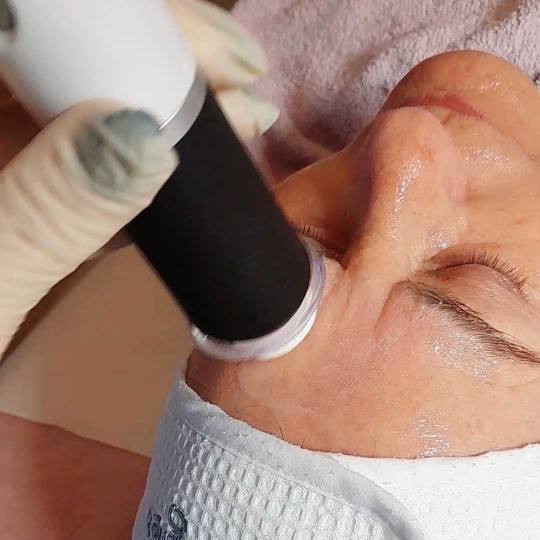 Natural #rijeka Lifting / zatezanje kože Oxygeneo Lifting / zatezanje kože