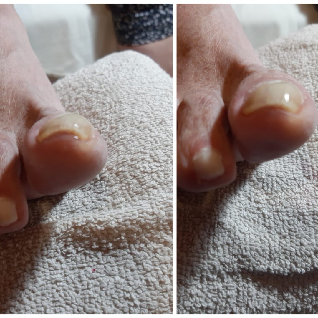 Lift up gel - More love beauty, Zagreb Estetska pedikura Nokti Estetska pedikura, Zagreb, Podsused – Vrapče