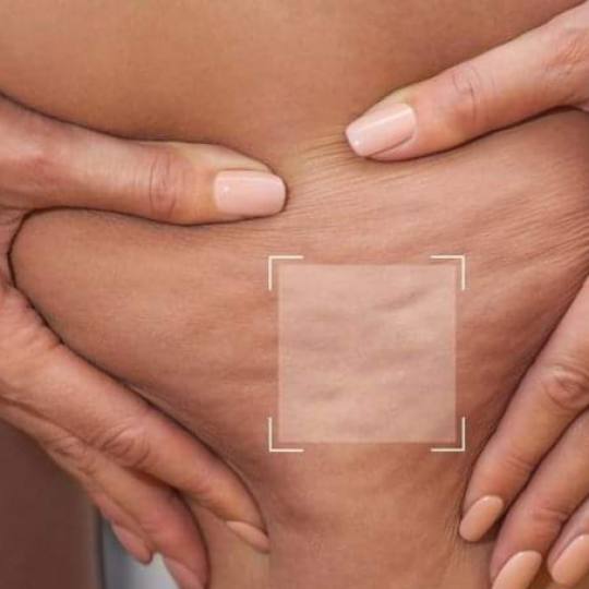 Antiage beauty room Lady Goga usluga