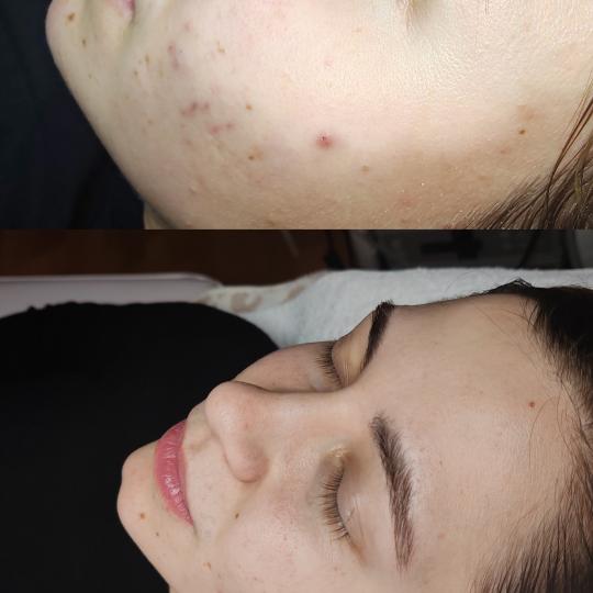Valena estetica usluga
