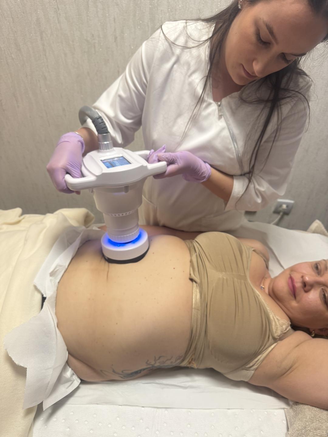 V6 Ultracontour - velika regija - Dahlia Beauty Studio, Zagreb Tretmani tijela Tijelo Tretmani tijela, Zagreb, Trnje