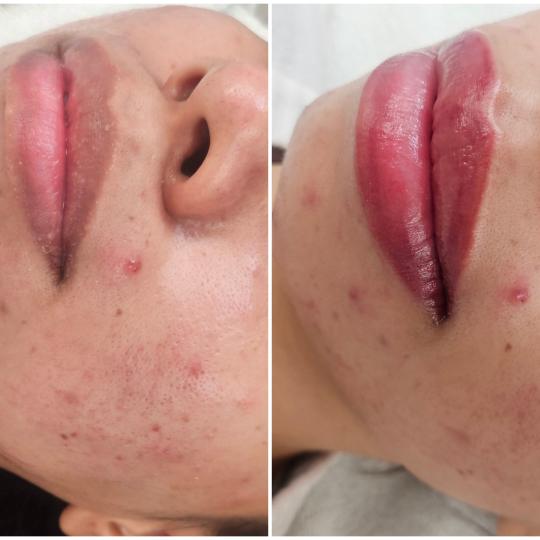 Cosmoderm & Centar Estetica usluga