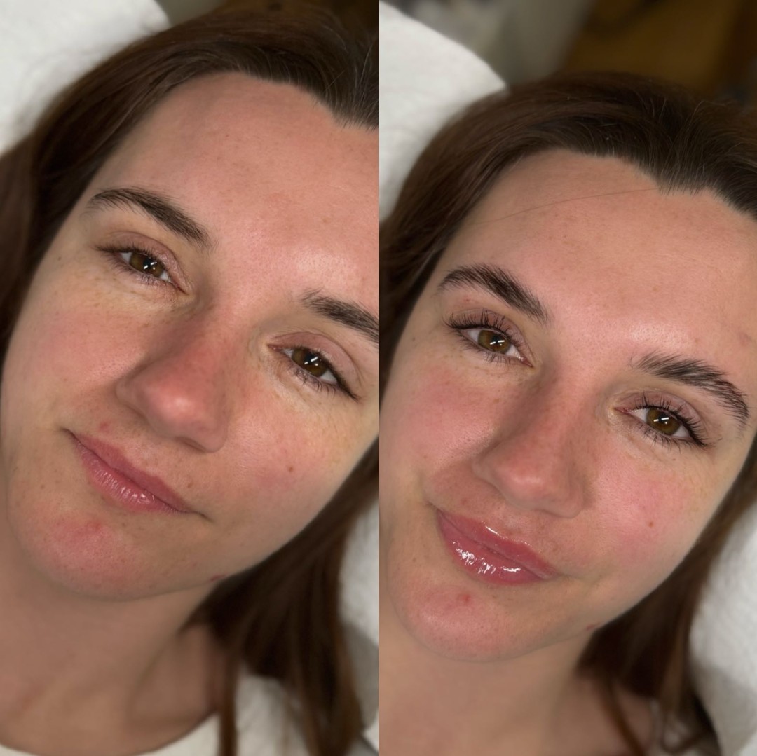 Lash lift + bojanje + 3D filler - MOELL beauty, Zagreb Trepavice Lice Trepavice, Zagreb, Peščenica – Žitnjak