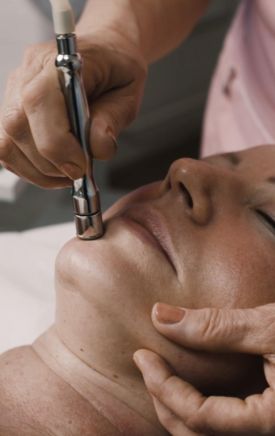 Royal Swiss Beauty #osijek Tretman lica Mikrodermoabrazija lica