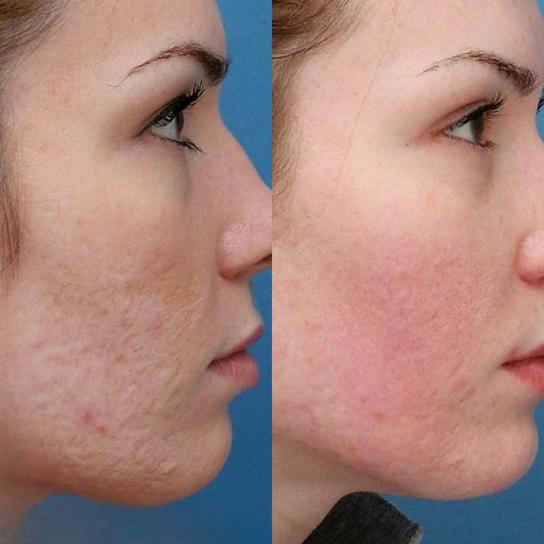 Aromavita Bella Donna #varazdin Tretman lica Apocalypsis tretman