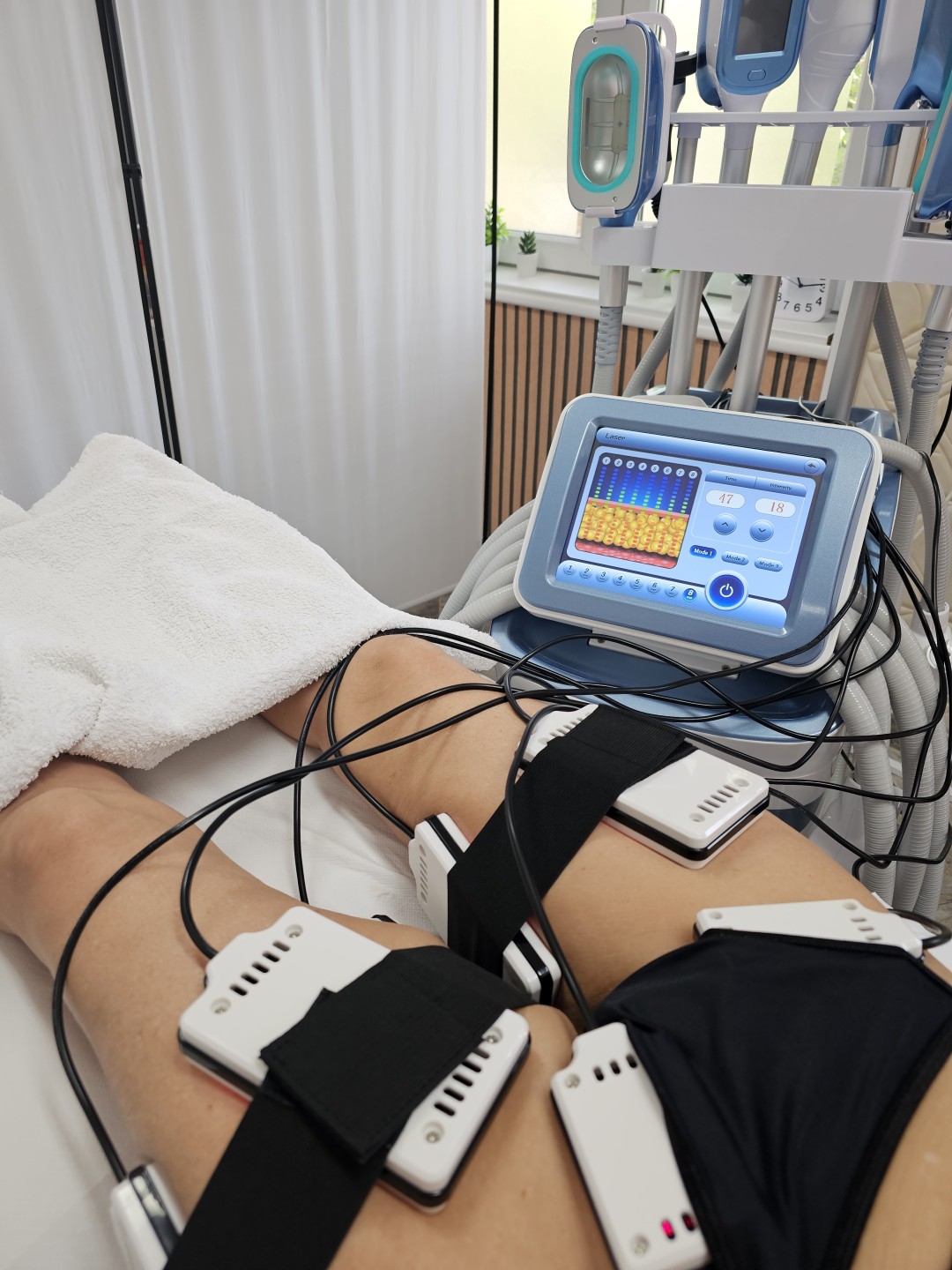 S M Beauty Bloom #zadar Tretmani tijela Lipo laser